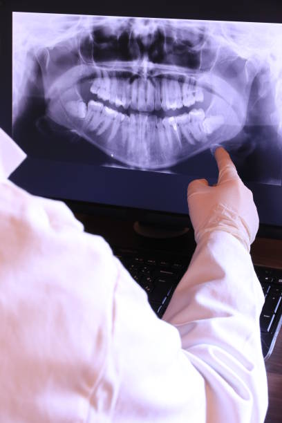 Best Emergency Wisdom Tooth Extraction in Dumfries, VA